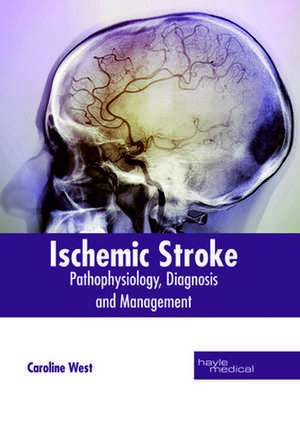 Ischemic Stroke de Caroline West