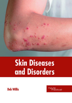 Skin Diseases and Disorders de Deb Willis