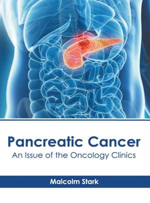 Pancreatic Cancer: An Issue of the Oncology Clinics de Malcolm Stark