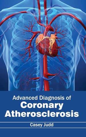 Advanced Diagnosis of Coronary Atherosclerosis de Casey Judd