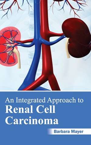 Integrated Approach to Renal Cell Carcinoma: History, Mechanism and Advances de Barbara Mayer