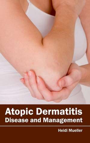 Atopic Dermatitis de Heidi Mueller