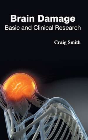 Brain Damage de Craig Smith