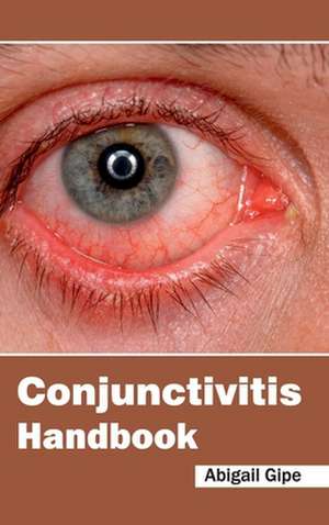 Conjunctivitis Handbook de Abigail Gipe