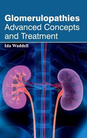 Glomerulopathies de Ida Waddell