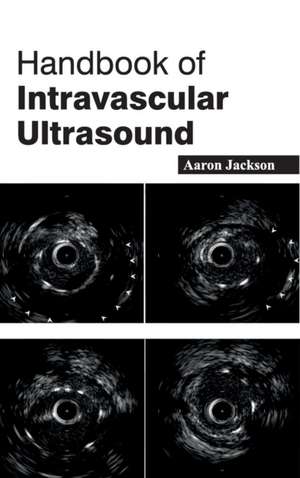 Handbook of Intravascular Ultrasound de Aaron Jackson