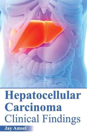 Hepatocellular Carcinoma de Jay Amsel