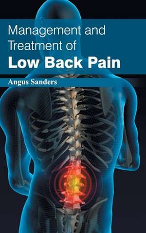 Management and Treatment of Low Back Pain de Angus Sanders