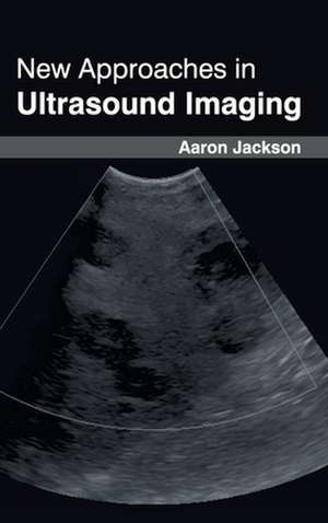 New Approaches in Ultrasound Imaging de Aaron Jackson