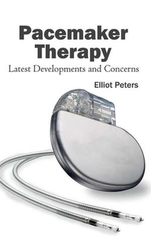 Pacemaker Therapy de Elliot Peters