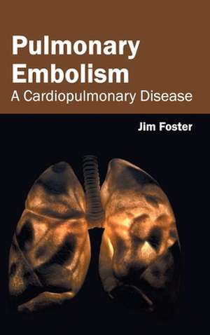 Pulmonary Embolism de Jim Foster