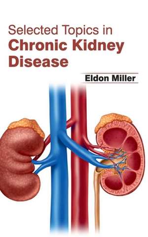 Selected Topics in Chronic Kidney Disease de Eldon Miller