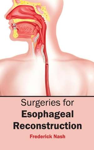 Surgeries for Esophageal Reconstruction de Frederick Nash