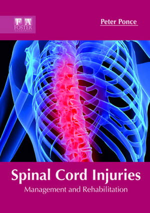 Spinal Cord Injuries de Peter Ponce