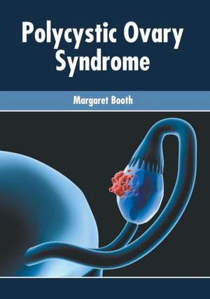 Polycystic Ovary Syndrome de Margaret Booth