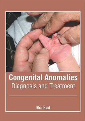 Congenital Anomalies: Diagnosis and Treatment de Elsa Hunt