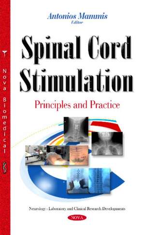 Spinal Cord Stimulation: Principles & Practice de Dr Antonios Mammis