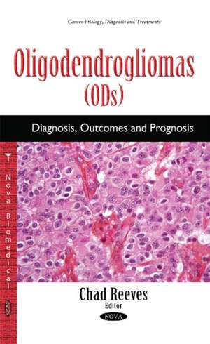 Oligodendrogliomas (ODs): Diagnosis, Outcomes & Prognosis de Chad Reeves