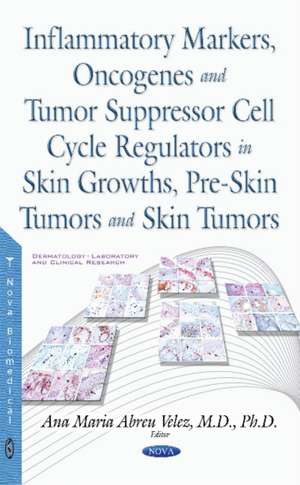 Inflammatory Markers, Oncogenes, Tumor Suppressor Cell Cycle Regulators in Skin Growths, Pre-Skin Tumors & Skin Tumors de Ana Maria Abreu Velez MD, Ph.D.