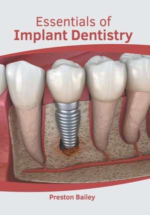 Essentials of Implant Dentistry de Preston Bailey