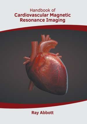 Handbook of Cardiovascular Magnetic Resonance Imaging de Ray Abbott