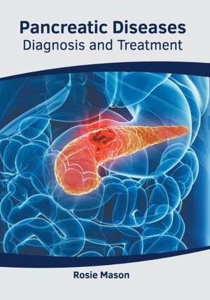 Pancreatic Diseases: Diagnosis and Treatment de Rosie Mason