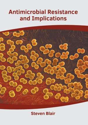 Antimicrobial Resistance and Implications de Steven Blair