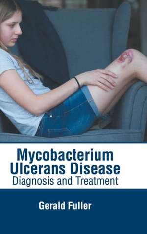 Mycobacterium Ulcerans Disease: Diagnosis and Treatment de Gerald Fuller