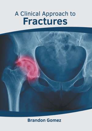 A Clinical Approach to Fractures de Brandon Gomez