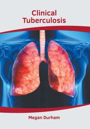 Clinical Tuberculosis de Megan Durham