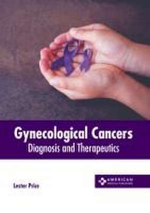 Gynecological Cancers: Diagnosis and Therapeutics de Lester Price