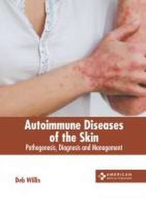 Autoimmune Diseases of the Skin: Pathogenesis, Diagnosis and Management de Deb Willis