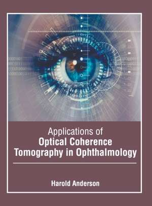 Applications of Optical Coherence Tomography in Ophthalmology de Harold Anderson