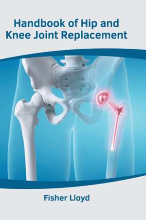 Handbook of Hip and Knee Joint Replacement de Fisher Lloyd