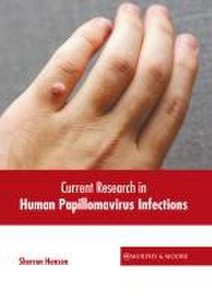 Current Research in Human Papillomavirus Infections de Sherron Hensen