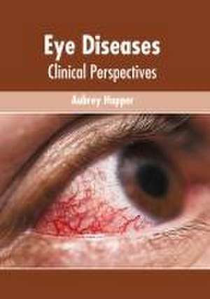 Eye Diseases: Clinical Perspectives de Aubrey Hopper