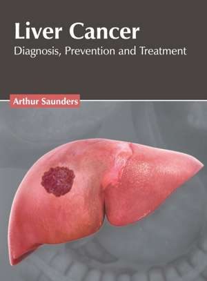 Liver Cancer: Diagnosis, Prevention and Treatment de Arthur Saunders