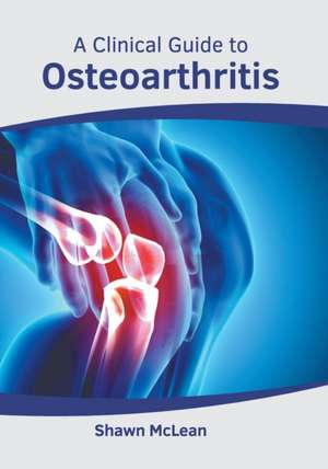 A Clinical Guide to Osteoarthritis de Shawn McLean