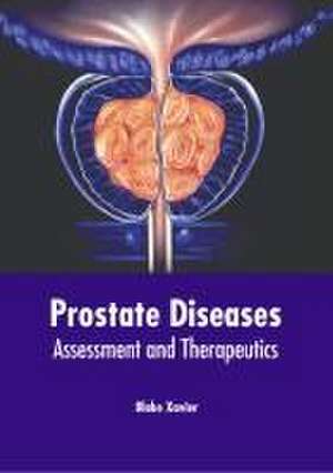 Prostate Diseases: Assessment and Therapeutics de Blake Xavier