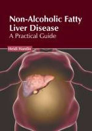 Non-Alcoholic Fatty Liver Disease: A Practical Guide de Heidi Hamlin