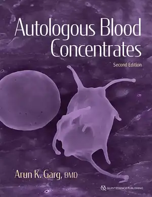 Autologous Blood Concentrates de Arun K. Garg