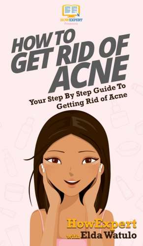 How To Get Rid of Acne de Howexpert