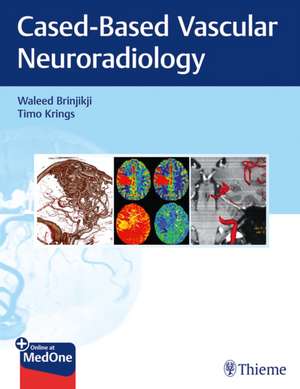 Imaging in Neurovascular Disease – A Case–Based Approach de Waleed Brinjikji