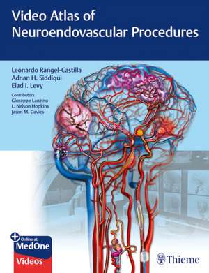 Video Atlas of Neuroendovascular Procedures de Leonardo Rangel–castilla