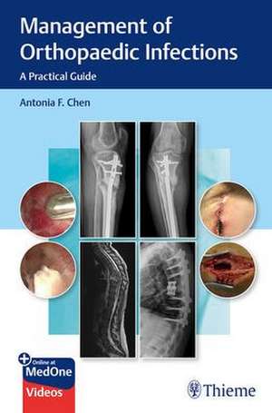 Management of Orthopaedic Infections – A Practical Guide bestseller.ro