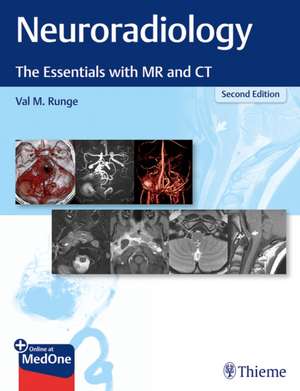 Neuroradiology – The Essentials with MR and CT: The Essentials with MR and CT de Val M. Runge