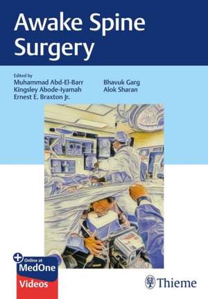 Awake Spine Surgery de Muhammad Abd-El-Barr