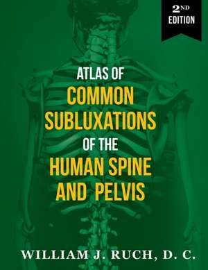 Atlas of Common Subluxations of the Human Spine and Pelvis, Second Edition de DC William J Ruch