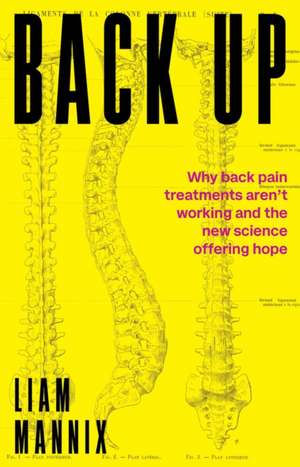 Back Up de Liam Mannix
