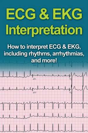 ECG & EKG Interpretation de Jeremy Pine